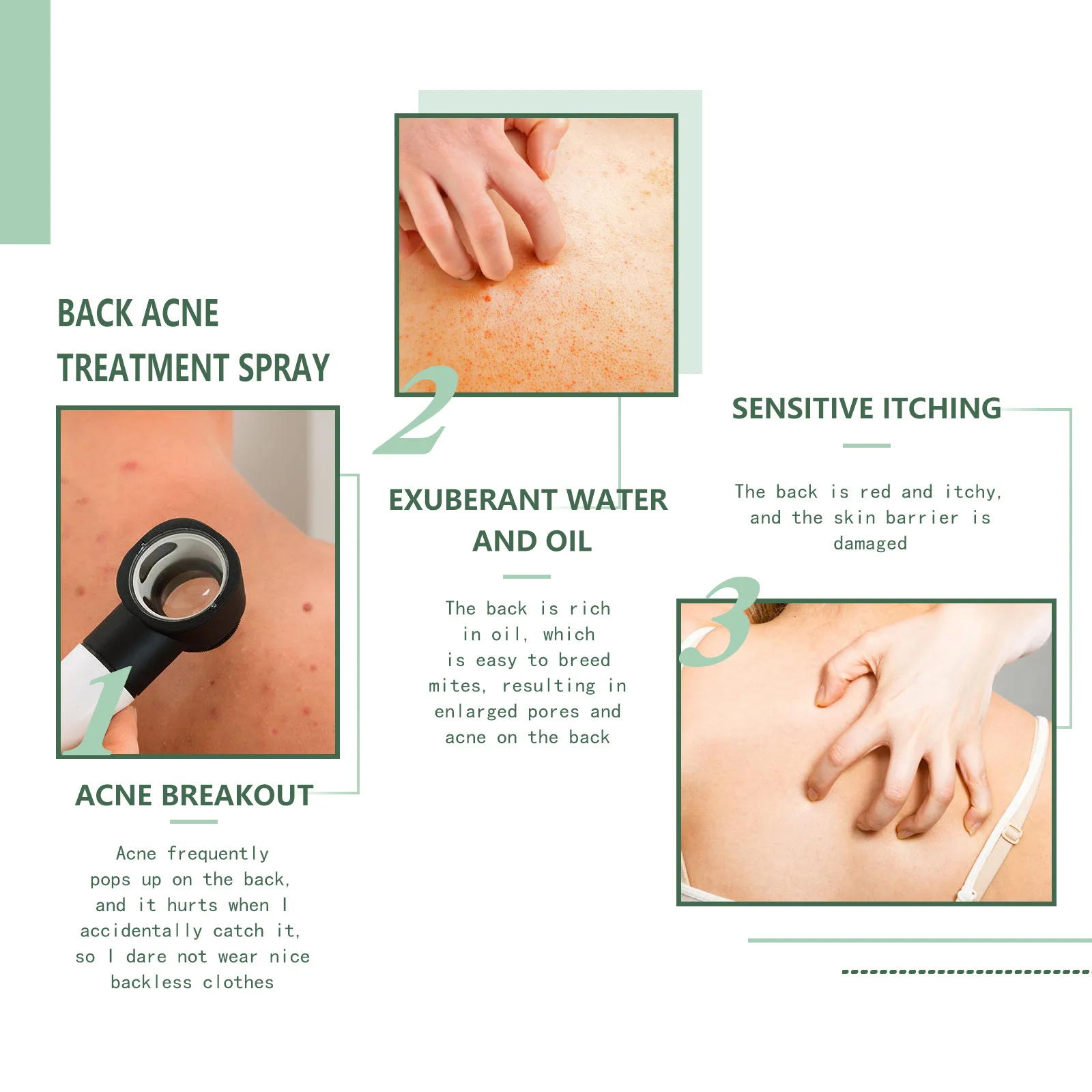 Back Acne Treatment Spray Salicylic Acid Fade Acne Mark Repair Pimple Spot Shrink Pore Moisturizing Soothe Body W-hitening Serum