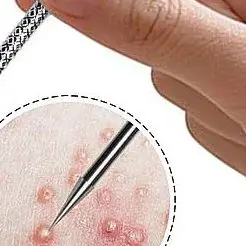 4 قطعة مجموعة إبر حب الشباب النقاط السوداء بثرة مزيل الرؤوس السوداء Comedone النازع المسام الأنظف أدوات تنظيف الوجه منتجات العناية بالبشرة #1