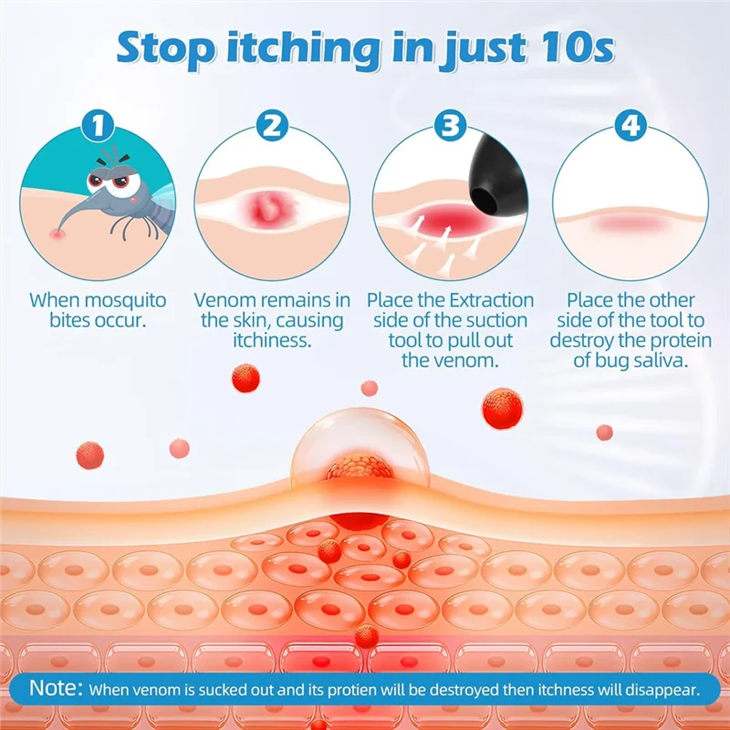 Insektenstiche-Entlastungsstift und Hitze zur Linderung von Mückenstitchen, Sommer-Outdoor-Gadget, schnelle Linderung von Insekten und Mücken, Bitesa83x