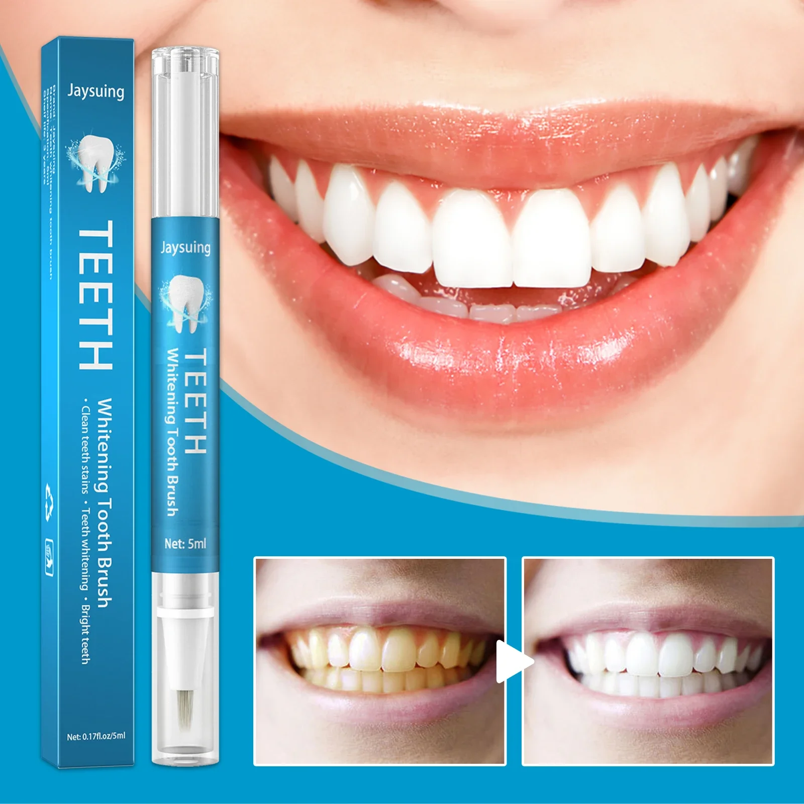 5pcs ที่มีประสิทธิภาพปากกาฟอกสีฟันฟันกาว Whitener Stain Remover Oral Hygiene Instant Smile ฟันทําความสะอาดเซรั่ม