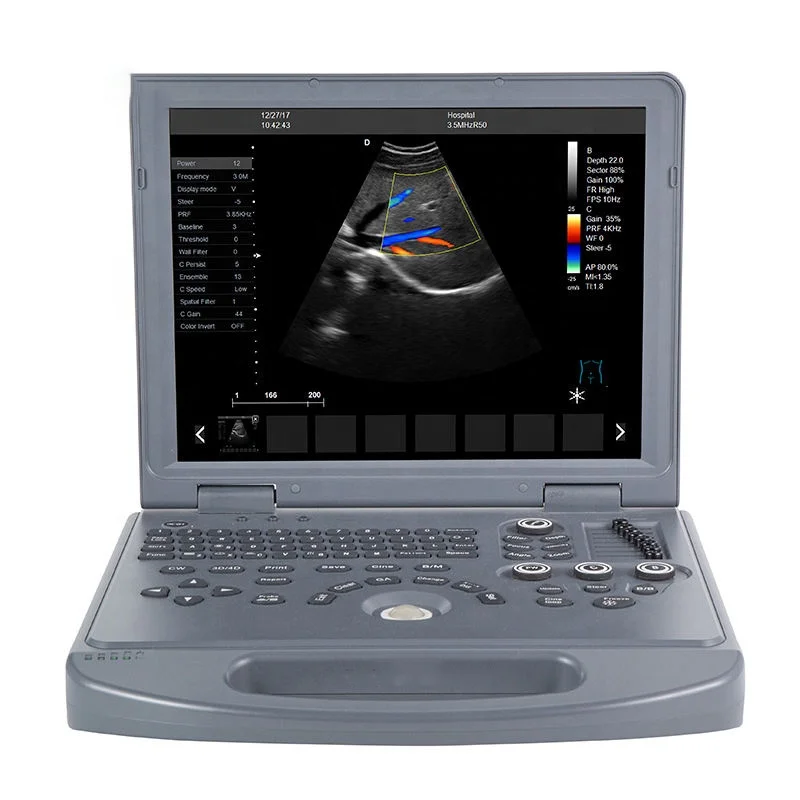 EUR PET Best Price Co lor Do ppler Ultr asound Scanner Veterinary Equipment Laptop Ultraso und Machine For Cattle