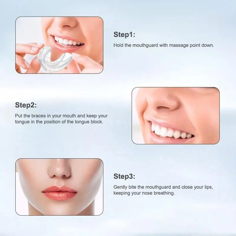 23GF 치열 교정 브레이스 치과기구 인스턴스 미소 치아 스트레이트너