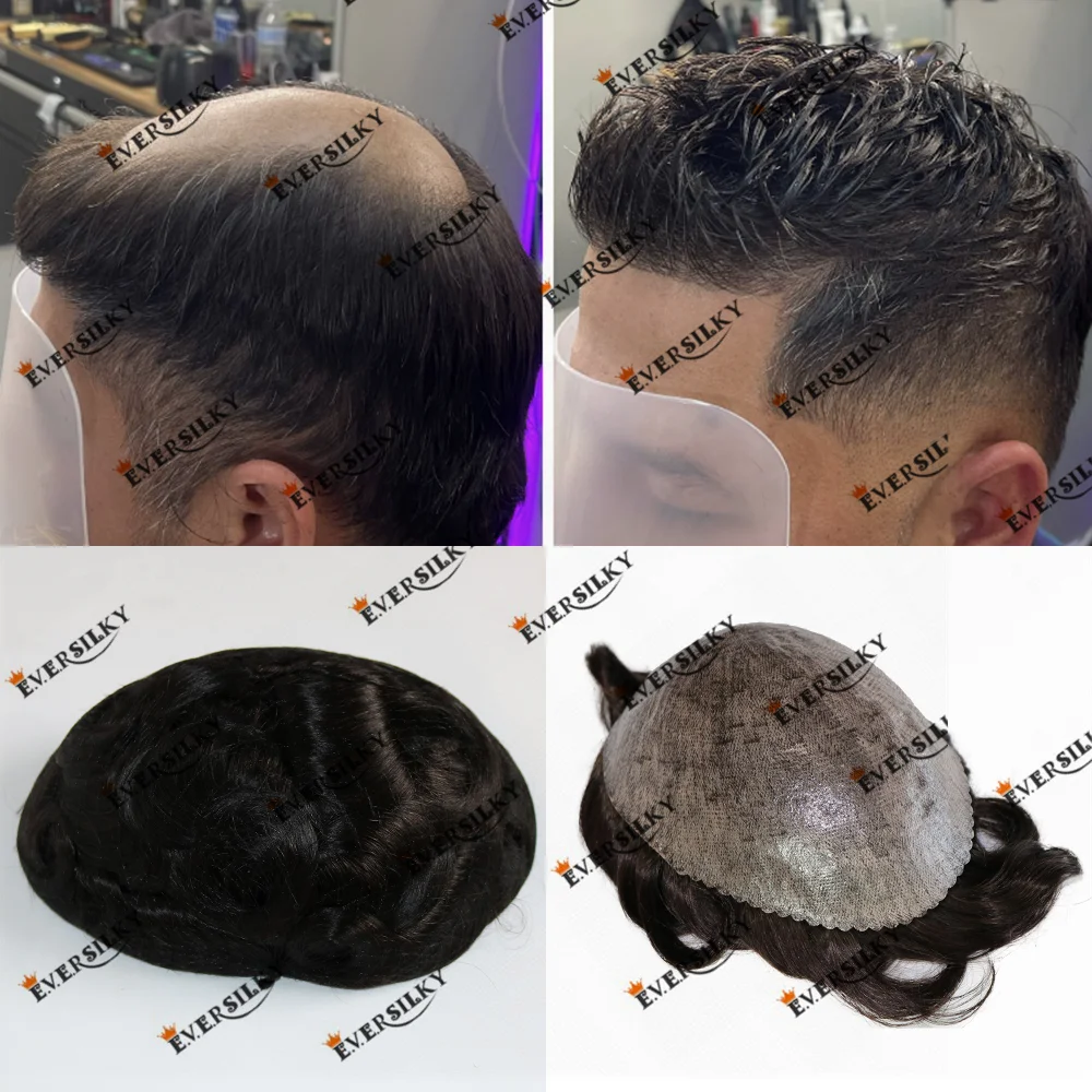 Durable Poly Skin Injected Human Hair Prosthesis for Men Replacement Hair Patch Brown Hair Men's Wig 110% Density Natural Hair