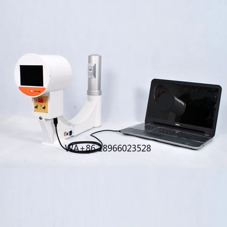 Portable digital floroscope x ray machine, fluoroscopy connected with extra LCD screen