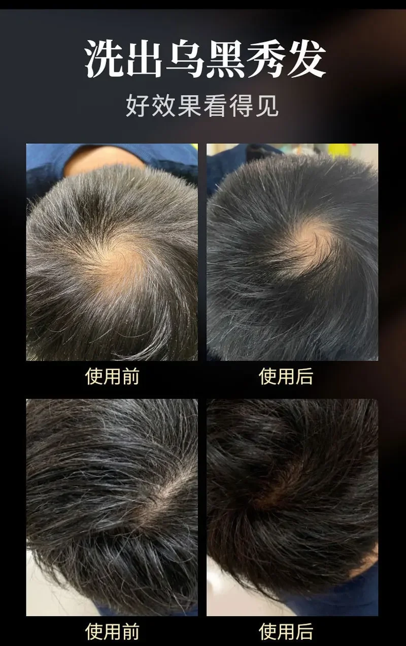 Hair Darkening Shampoo Soap Natural Organic Long-lasting Use Hair Care Polygonum Darkening Repair He Shou Wu Essence Hair Soap