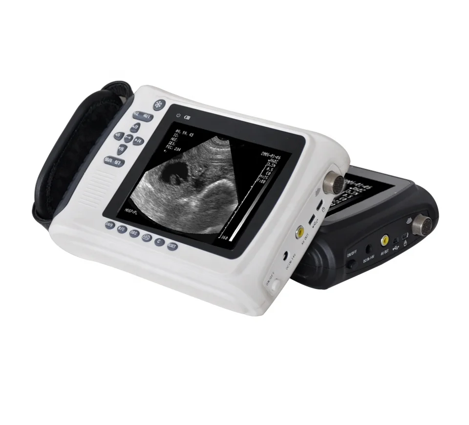 

Professional veterinarian handheld 5 inch portable digital cattle ultrasound machine veterinary