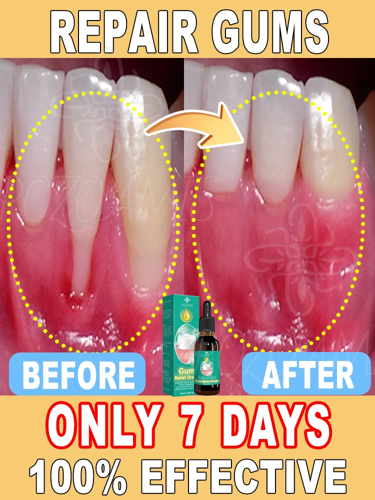 

Repair damaged gums, relieve gum pain, strengthen gums, restore healthy gums! ! ! !