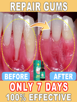 Gum recession, bleeding teeth, and tooth pain will all disappear. The most powerful technology in 2025