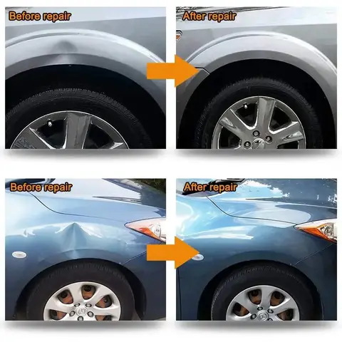 10 best sales डेंट टूल - №1