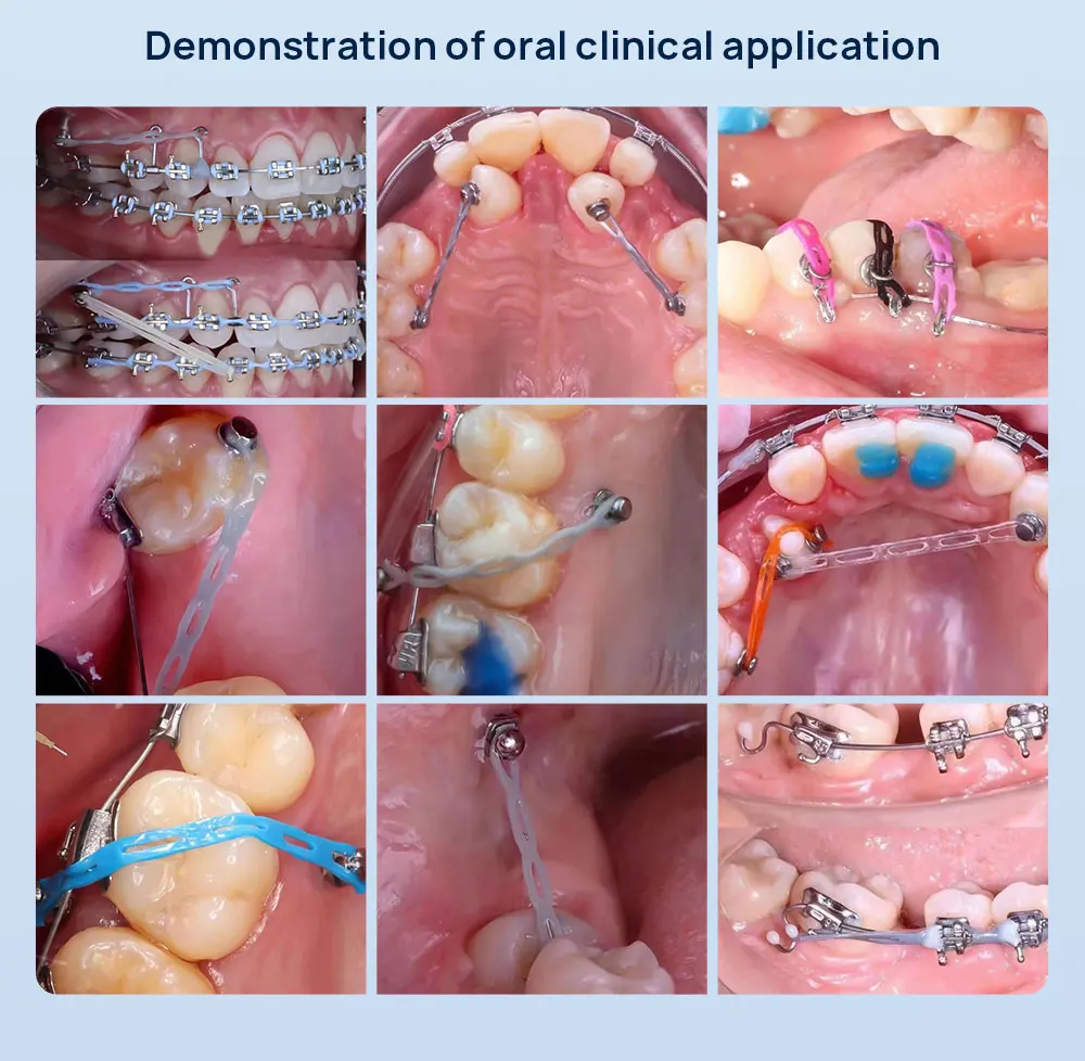 10 Rollen AZDENT Dental Kieferorthopädische Elastische Power-Kette Farbig, Länge Lang, Kurz, Kontinuierlich, Gemischte Farben, 15' pro Spule, Zahnmedizin – Detail 6