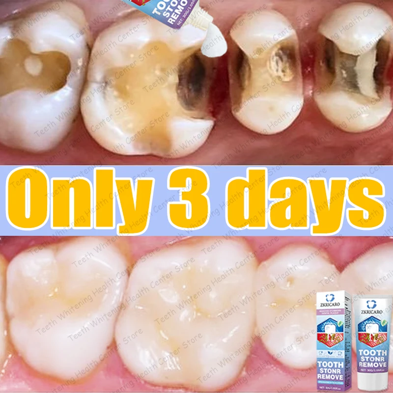 

99% людей закупайте убийцу карниза с зубами