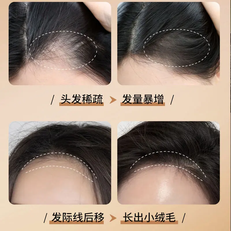 شامبو SADOER Ginger لنمو الشعر، التحكم في زيت النباتات، مضاد للقشرة، شامبو مضاد لتساقط الشعر