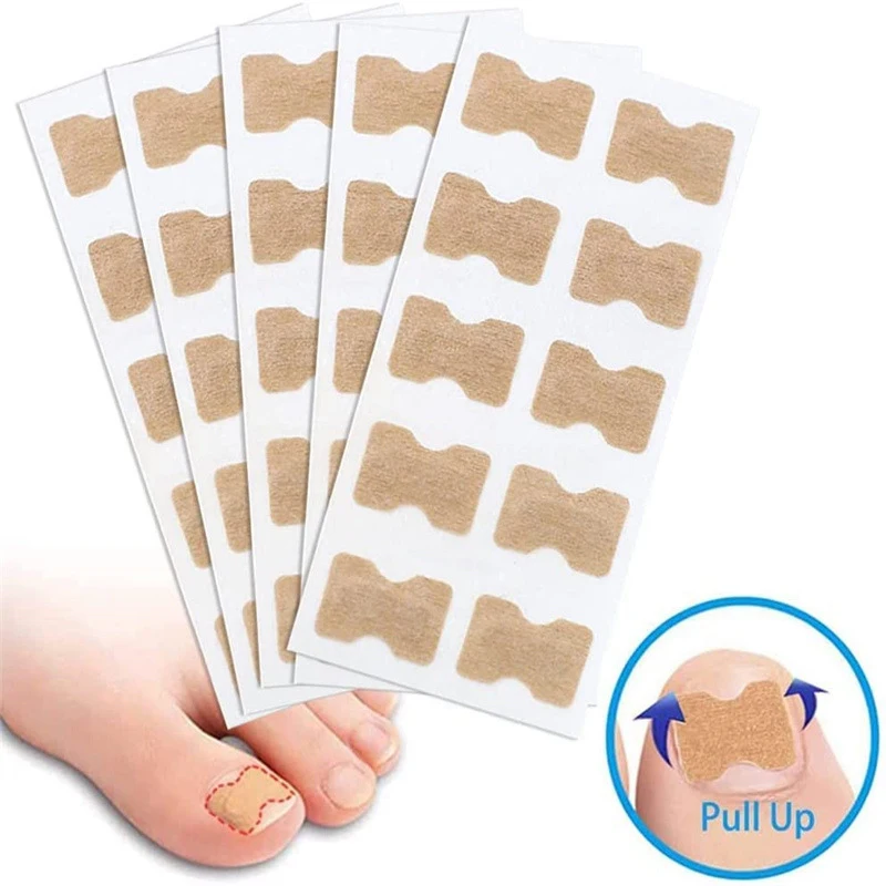 100 pz Unghia Del Piede Fungo Patch Appiccicoso Riparazione Delle Unghie Patch Unghie Incarnite Adesivo di Correzione Cura Dell'unghia Del Piede Paronichia Patch Per Unghie