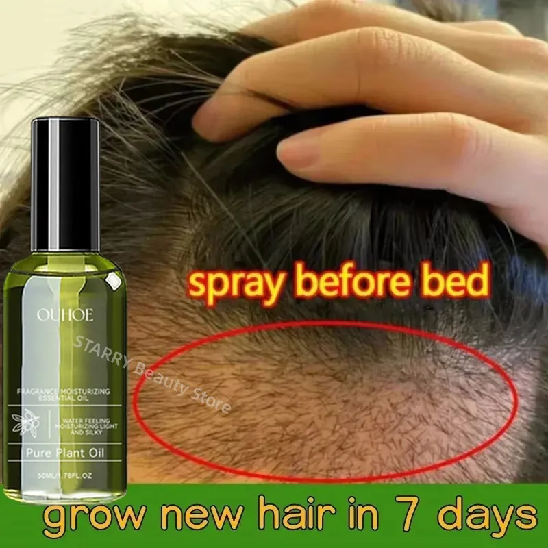 

Fast Hair Growth Serum Spray Hair Growth Products Anti Hair Loss Treatment Essential Oil Repair Nourish Hair Root For Men Women