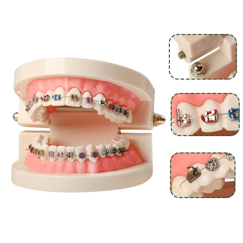 Orthodontics Denture Model with Colorful Braces Denture Mouth Model Display Teaching Model for Dentistry Dental Study Supplies