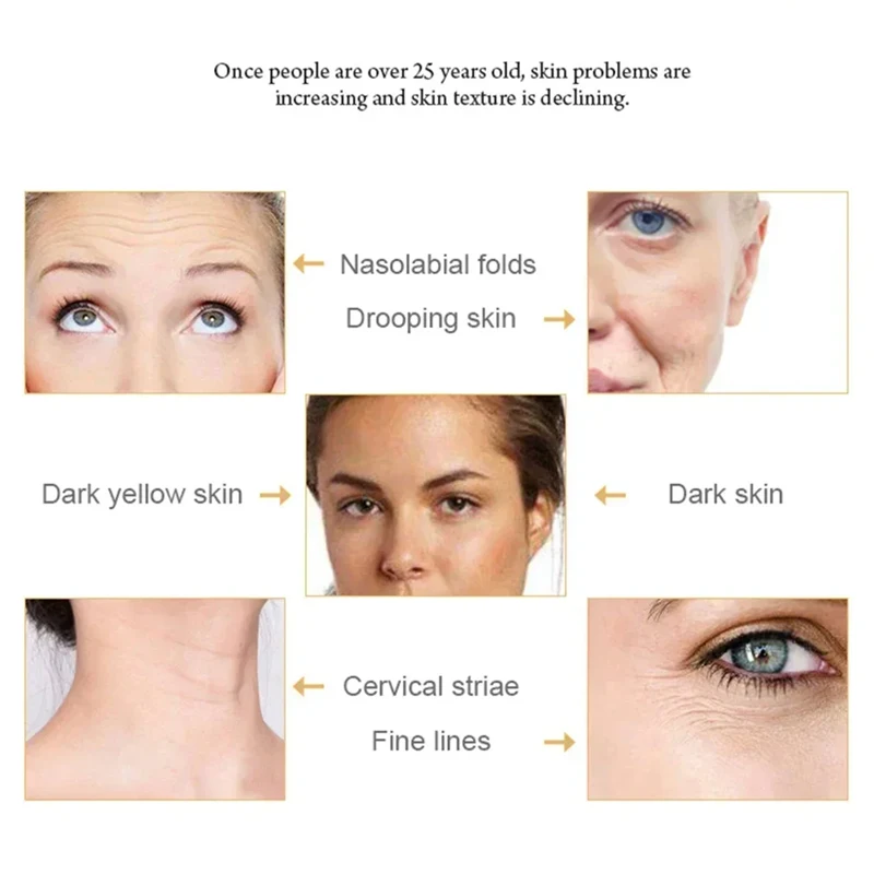 جهاز صغير HIFU بالموجات فوق الصوتية EMS جهاز تجميل الوجه مكركرنت لشد العناية بالبشرة أداة مضادة للتجاعيد للوجه