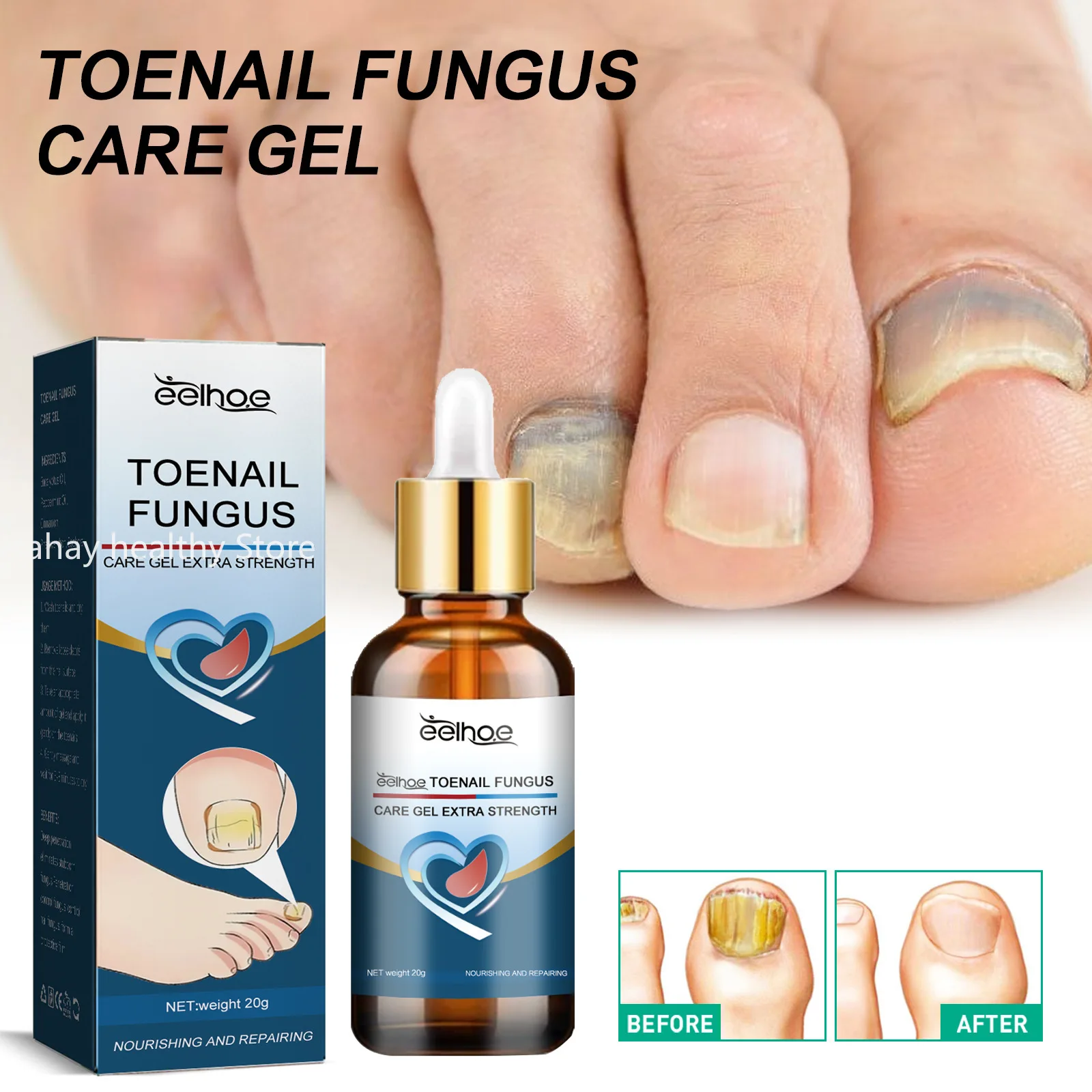 Toenail Repair 20g Nail Repair for Damaged Nails for Toenail or Fingernail Safe Nail Solution for Discolored Damaged Nails