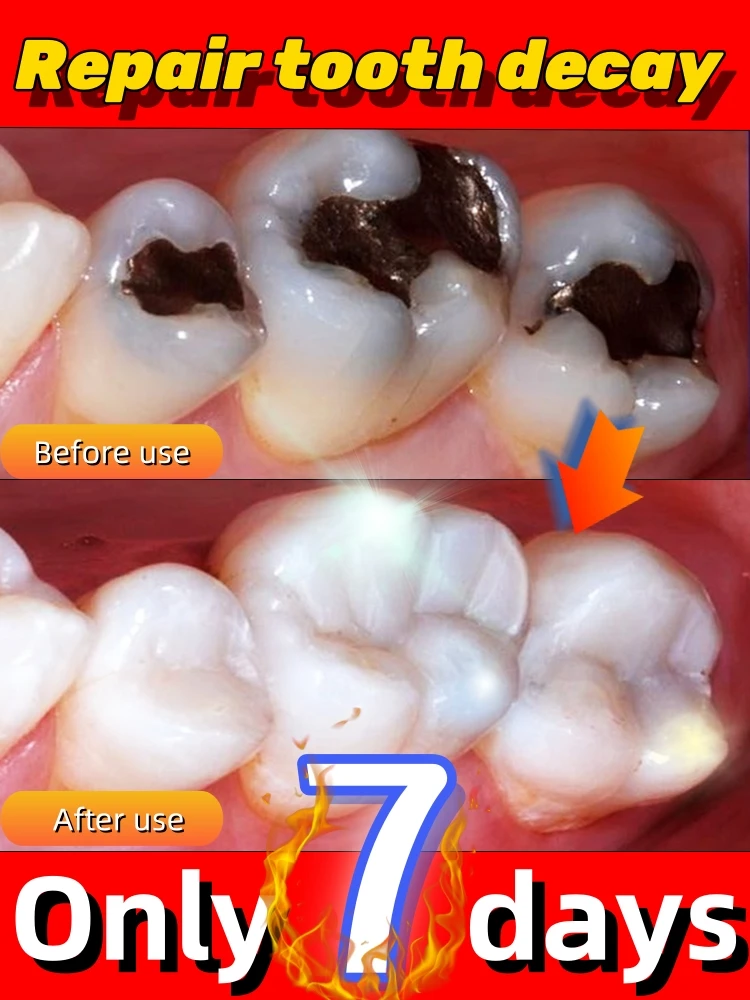 Targeted solutions to protect your teeth