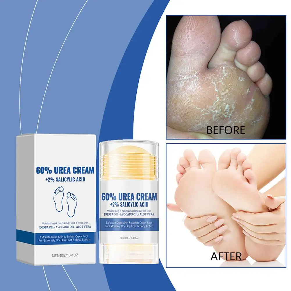 40g Ultra-Hydrating 60% Urea Foot Cream Aloe Vera for Softening Dry Cracked Feet - Gentle Exfoliation Daily Foot Care Solut W4Z4