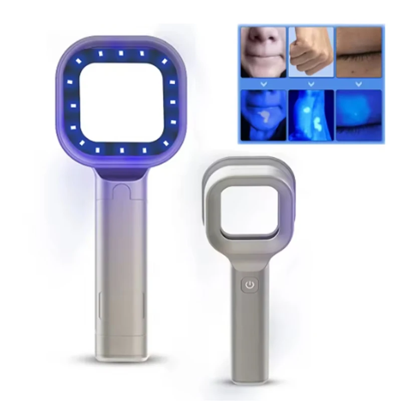 皮膚検査用ウッドランプテスト医療診断分析機紫外線顔面皮膚分析パーソナルビューティーケア