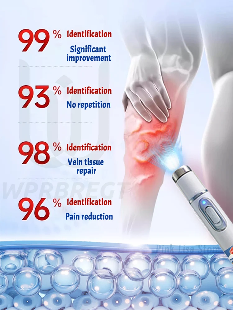Verabschieden Sie sich von Krampfadern