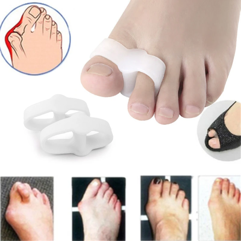 1Pair Toe Overlapping Splitter Gel Silicone Feet Care Hallux Valgus Straighteners Corrector Separators Bunions Pain Relieve