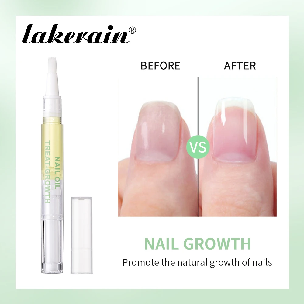 Nail Treat-Growth Cuticle Oil Bright Oil Texture Repair Damaged Nail Surface Strengthen Moisturize Growth Shine Nail Cuticle Oil