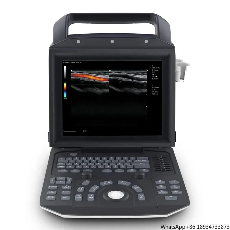 Medical color doppler ultrasound portable CW TDI cardiac ultrasound machine