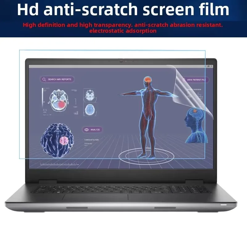 Película protectora de vidrio templado para teclado Dell Precision 7780 7770, película protectora de pantalla para portátil de 17,3 pulgadas, película protectora de vidrio templado HD a prueba de luz azul