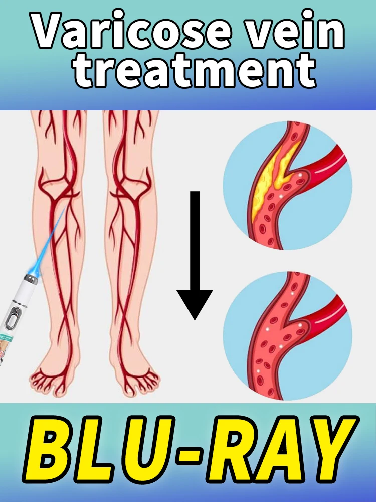 

2025 The latest technology blue laser eliminates fungi and restores healthy nails