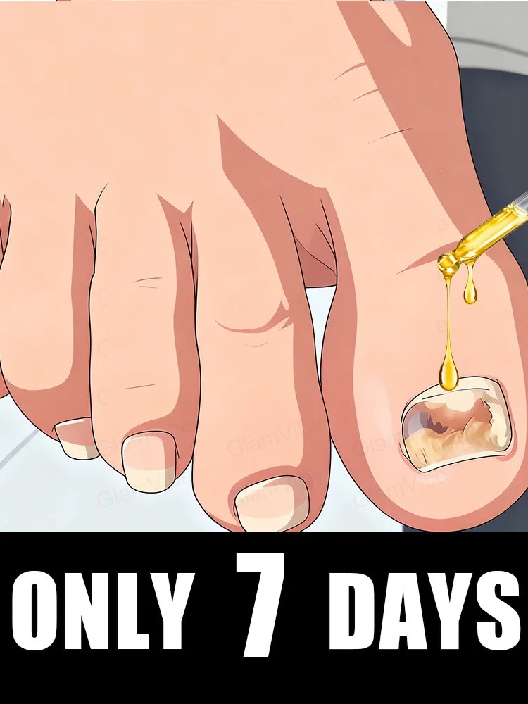 

Tᴏᴇɴᴀɪʟ Fᴜɴɢᴜs Pᴀᴛᴄʜᴇs Rᴇᴘᴀɪʀ Dɪsᴄᴏʟᴏʀᴇᴅ Dᴀᴍᴀɢᴇᴅ Nᴀɪʟs Fᴏᴏᴛ Cᴀʀᴇ2025