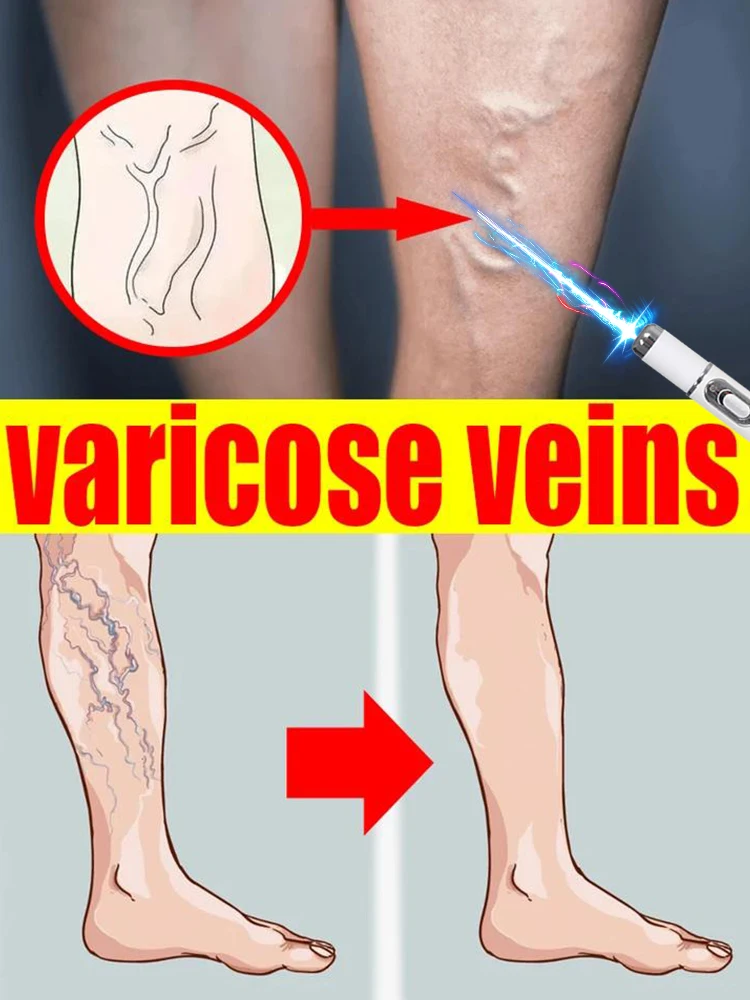 

Популярные аксессуары для ручек с синим светом, ручной массажер для икр, простой в использовании