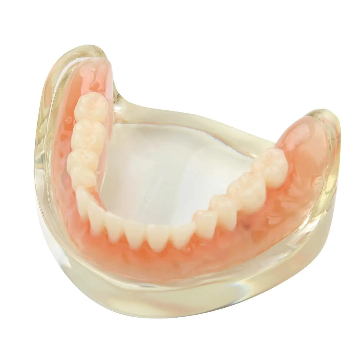 

Зубная модель нижней челюсти с 2 имплантатами для обучения и изучения (нижняя челюсть)