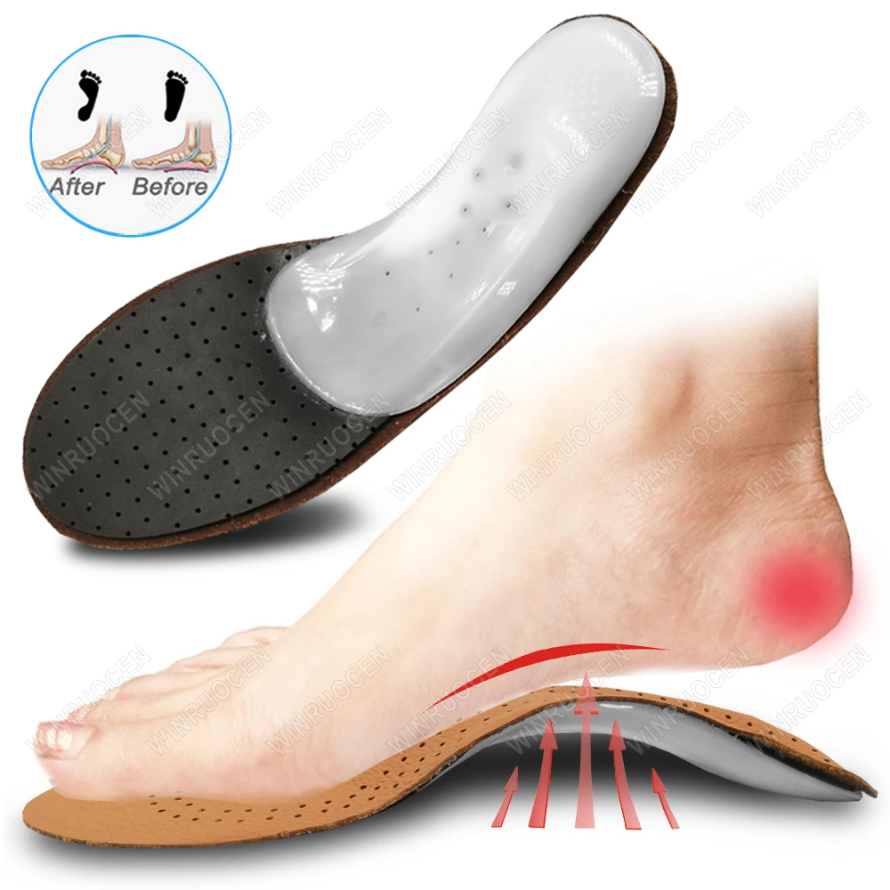 Genuine Leather Orthotic Insoles Flat Feet Arch Support O/X Leg Correction Unisex/Kids Orthopedic Shoe Sole Foot Inserts Pads