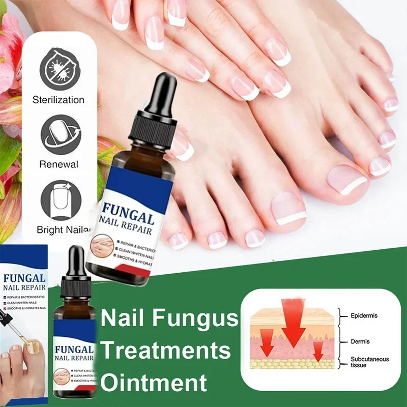 مرحبا الفطرية علاج الأظافر جوهر النفط فطريات الأظافر جهاز الليزر إصلاح أظافر أظافر علاج فطار الأظافر مع الفطر