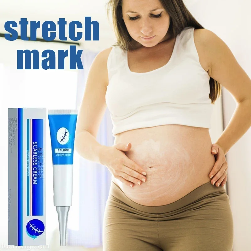 

HOT SALEStretch Mark Removal Cream Anti-wrinkle Skin Repair Cream Stretch Scar Body Mark Remover Smooth Ointment