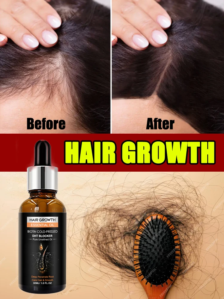 Hair Care Essence Oil Hair Growth Liquid Nourishing Scalp Awaken Hair Follicles Prevent Hair Loss