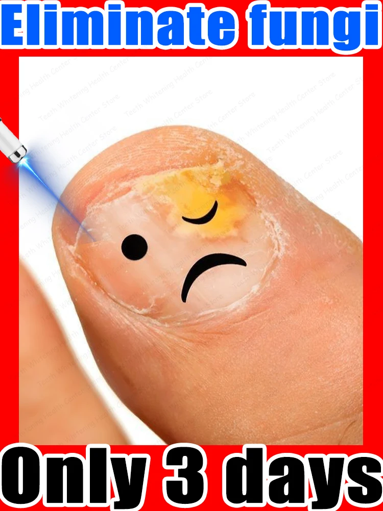 

Nail cleaning tools to restore nail health.