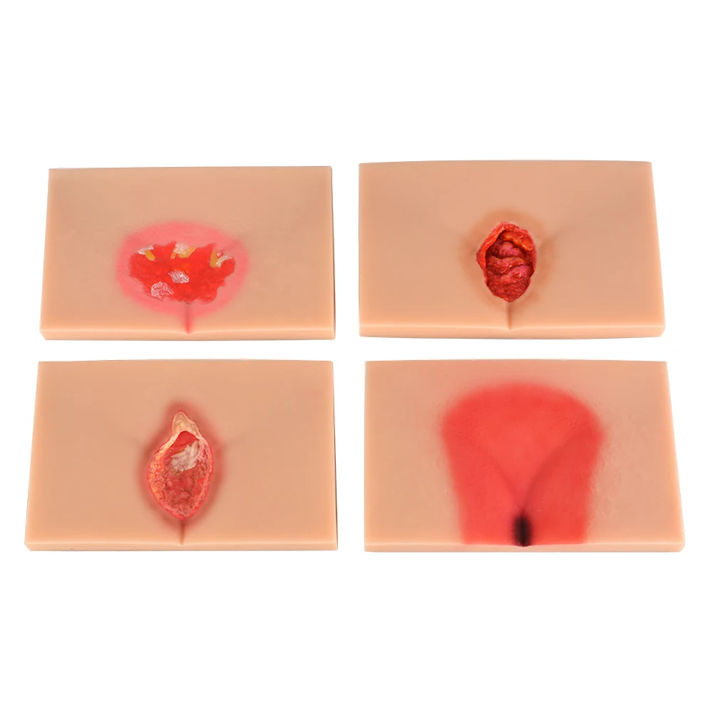 زخم ضغط السيليكون (المرحلة 1-4) نموذج تمريض مظاهرة، محاكي السيليكون، نموذج للتدريس