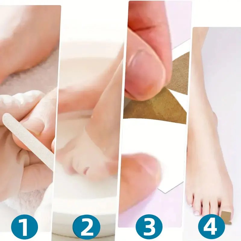 40/50/60/70 peças remendos multiuso para unhas dos pés, adesivos para unhas encravadas, kit de ferramentas profissionais para pedicure