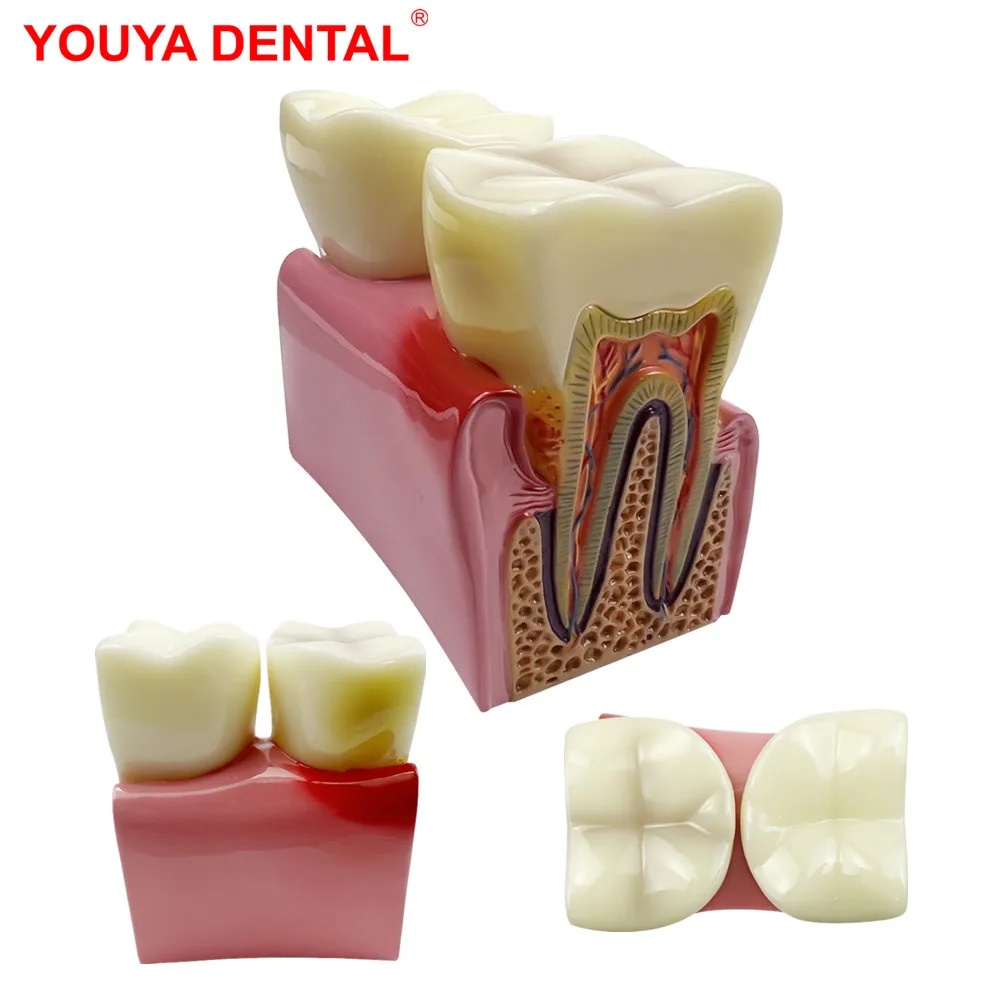 

Big Dental Teeth Model Anatomy Large Dental Anatomical Model For Teaching Studying Education Demonstration Patient Communication