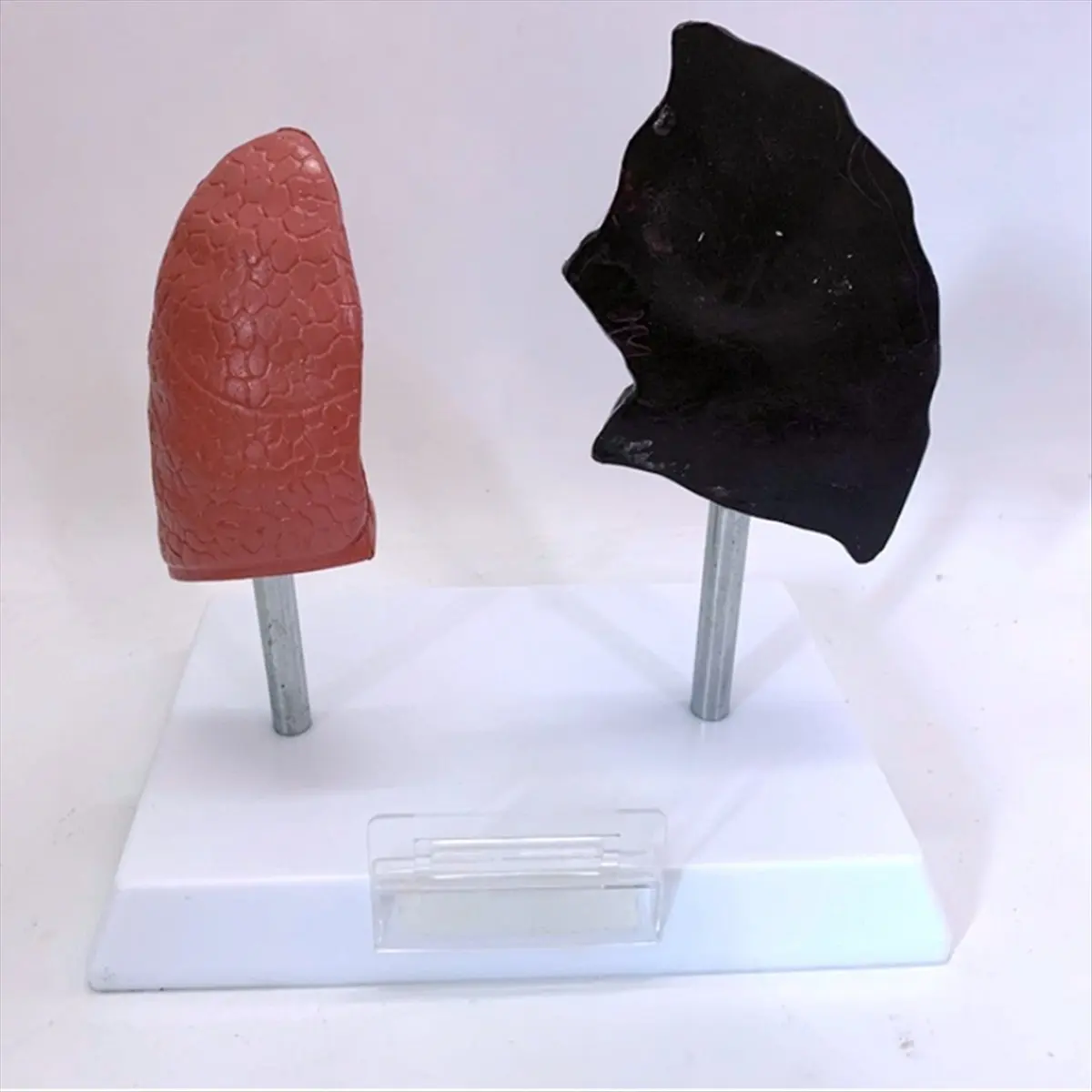 Eco-friendly Smoker'S Lung Model Healthy Lung Model Lung Anatomy Model with Pathological Respiratory System Disease Lungs