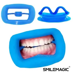 Tandheelkundige Zachte Siliconen 3d Lip Wang Retractor Mondopener Wang Expansie Tandheelkundige Orthodontische Verbruiksartikelen 4 Kleuren Beschikbaar