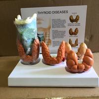 Thyroid disease Lesion Anatomical Model Thyroid Anatomy teaching mode