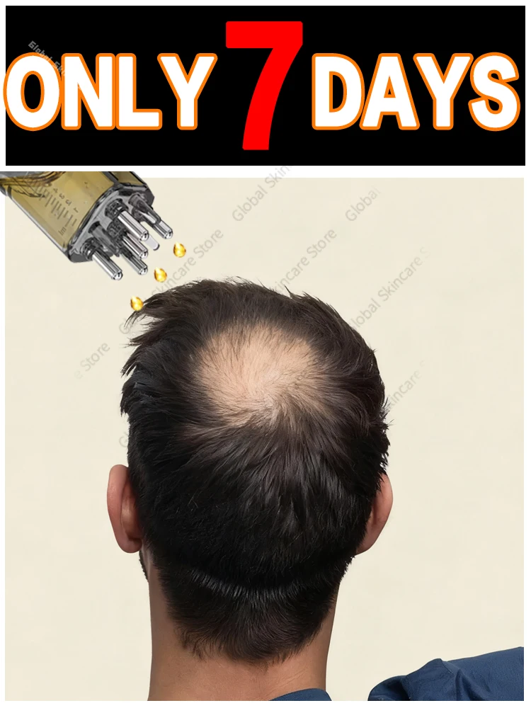 

The dormant hair follicles awaken, and the head becomes more luxuriant