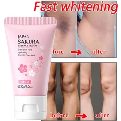 Inner Thigh Brighten Cream Bleaching Armpits Elbows Knees Moisturizing Body Lotion Cream Brighten Lightening Melanin Skin Cream