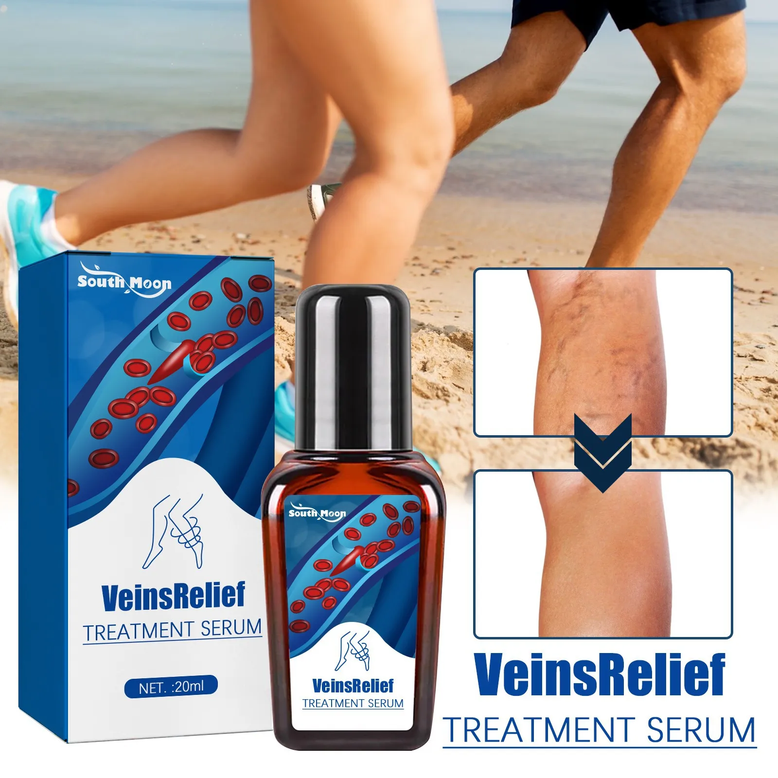 Vein Repair Fluid Relieves Leg Varicose Pain, Earthworm Legs with Bulging Veins, and Massage with Kangshu for Easy Relief