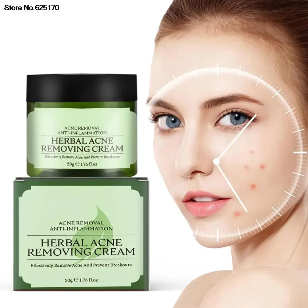 Herbal Acne Removendo Creme, Prevenir Breakout, Natural Blend, Propenso, Pele sensível, Controle de óleo, Rugosidade, Refrescante, Cuidados com a pele, 50g