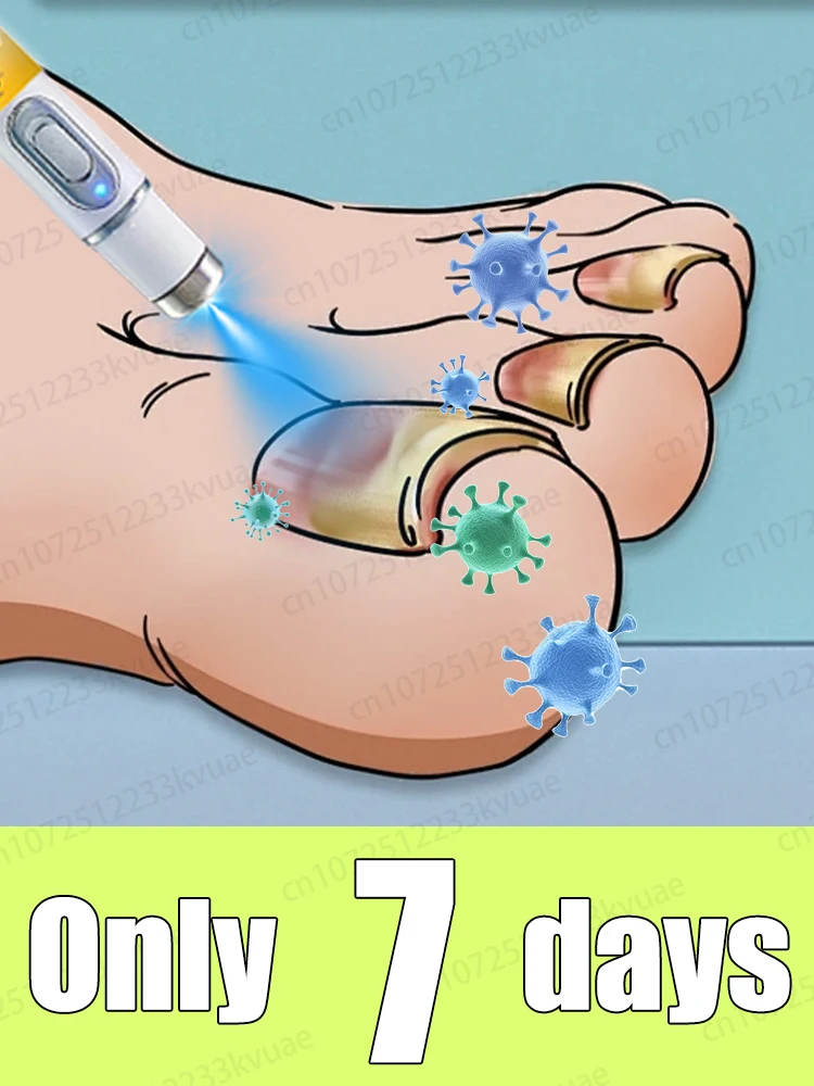 

Скажи прощайте на онихомикоз, без вторжения, без повреждения ногтей.