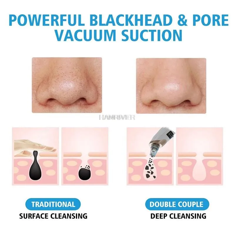 Blackhead Remover Vacuum Acne Pimple Black Spot Suction Electric Facial Pore Cleaner Skincare Exfoliating Beauty Instrument